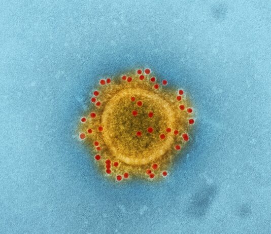 “기분이 우울할 땐 장이 보내는 신호일지도 모릅니다” a yellow substance with red dots in it